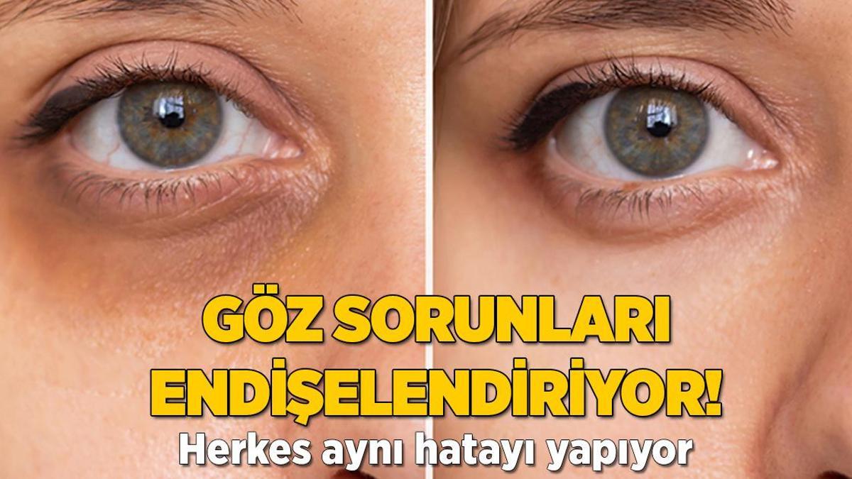 Göz çevresini mahvedip kırıştırıyor! Herkesin hatası aynı, parmak ucunuzla ovalayın