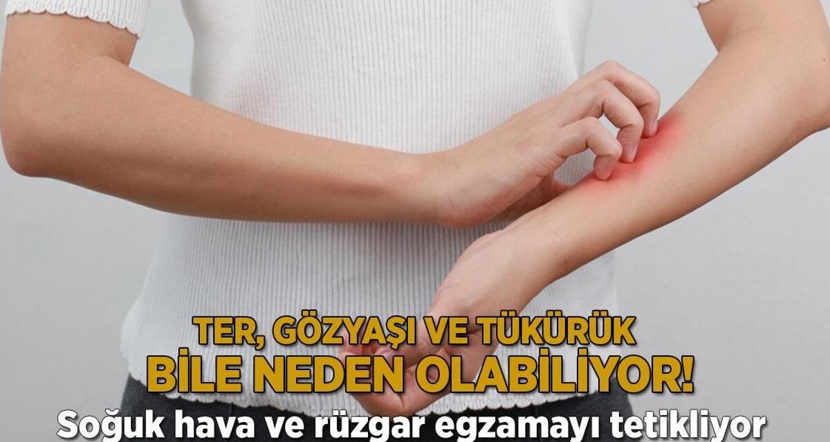 Ter, gözyaşı ve tükürük bile neden olabiliyor! Soğuk hava ve rüzgar egzamayı tetikliyor