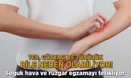 Ter, gözyaşı ve tükürük bile neden olabiliyor! Soğuk hava ve rüzgar egzamayı tetikliyor