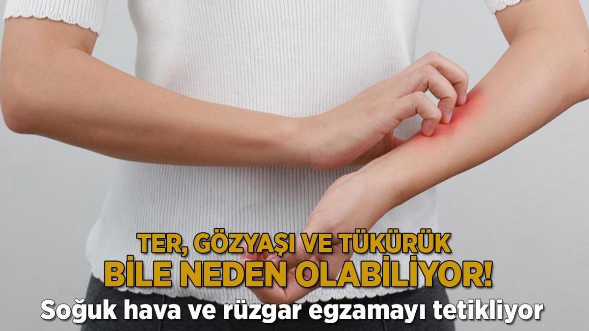 Ter, gözyaşı ve tükürük bile neden olabiliyor! Soğuk hava ve rüzgar egzamayı tetikliyor