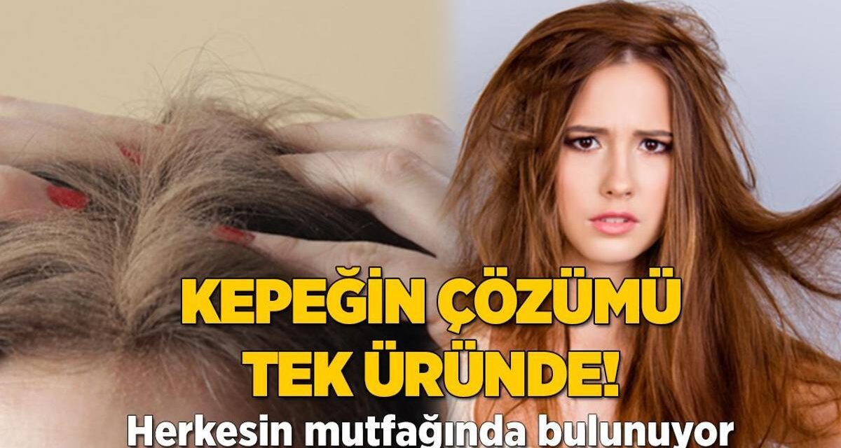 Şampuana para dökmeye gerek yok! Sinir bozucu kepeğin çözümü mutfakta saklı