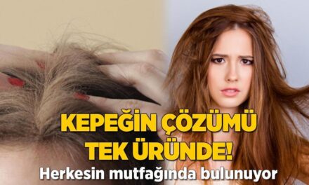 Kepeğin çözümü tek üründe! Herkesin mutfağında bulunuyor