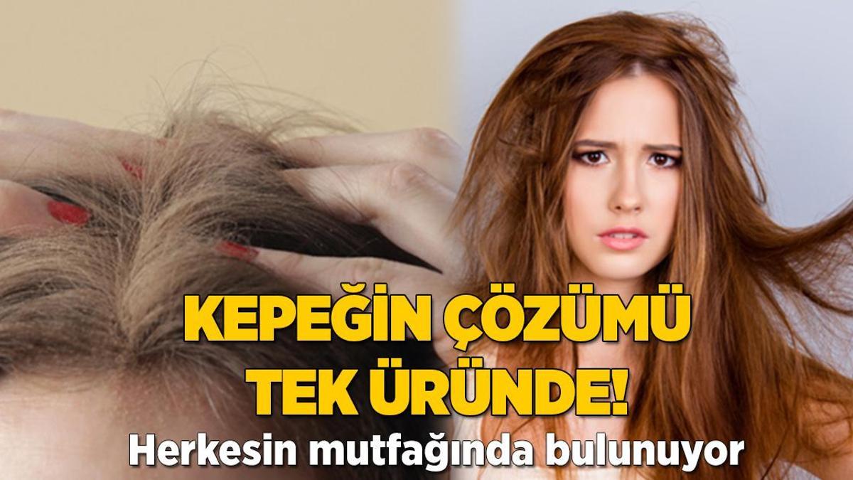 Şampuana para dökmeye gerek yok! Sinir bozucu kepeğin çözümü mutfakta saklı