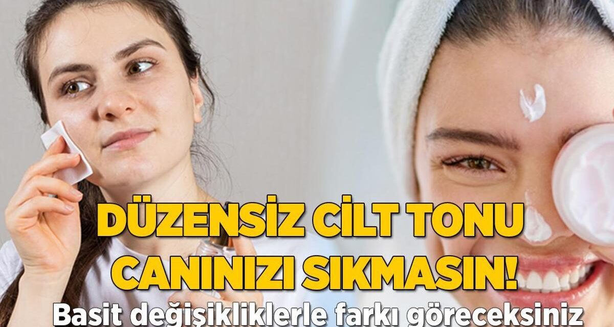 Düzensiz cilt tonu canınızı sıkmasın! Basit değişikliklerle farkı görün