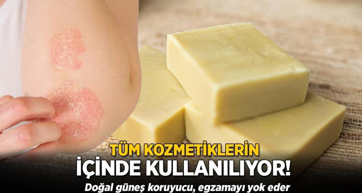 Afrika’dan tüm dünyaya yayılan mucize! Doğal güneş koruyucu, egzamayı bitiriyor