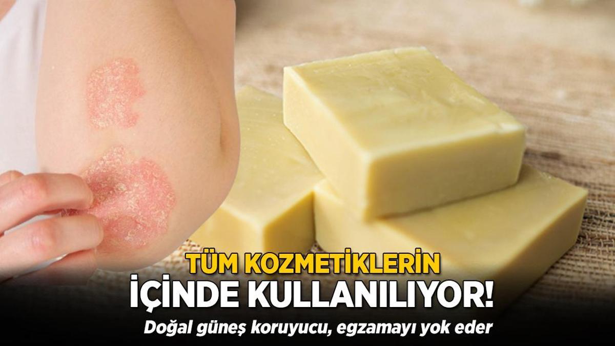 Afrika’dan tüm dünyaya yayılan mucize! Doğal güneş koruyucu, egzamayı bitiriyor