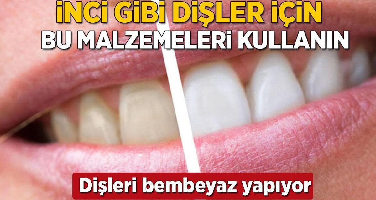 Dişçiye gitmeden inci gibi dişler! İşte evde bembeyaz yapmanın formülü