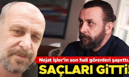 Saçlar gitti! Nejat İşler’in son hali görenleri şaşırttı…