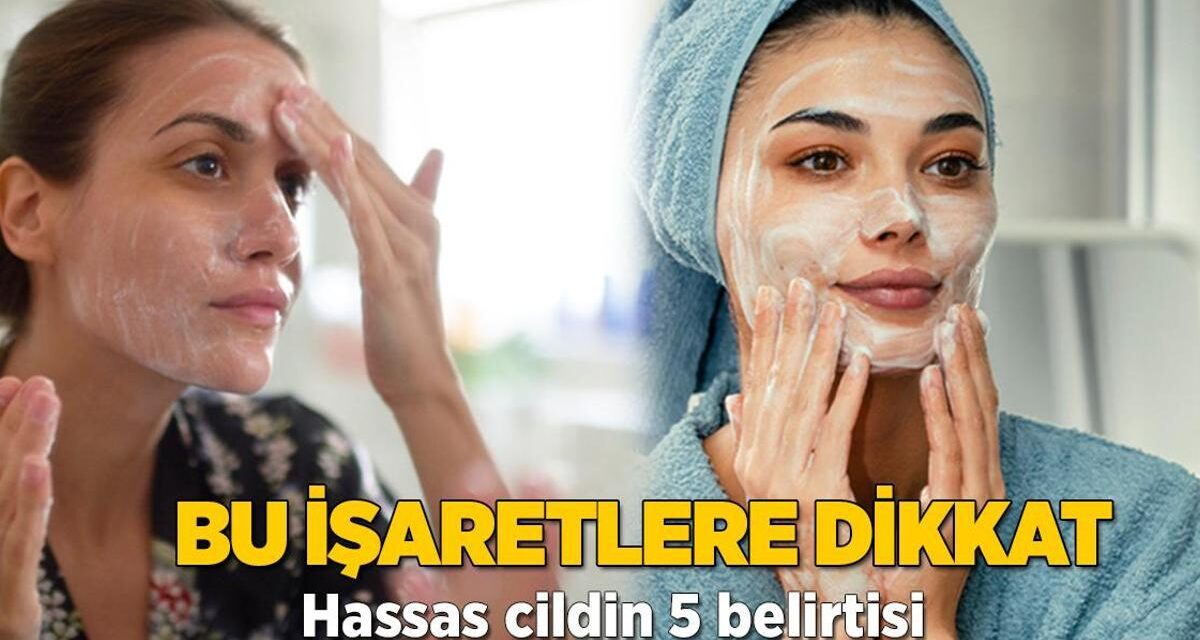 Bu işaretlere dikkat! Hassas cildin ‘Ben buradayım’ diyen 5 sinyali