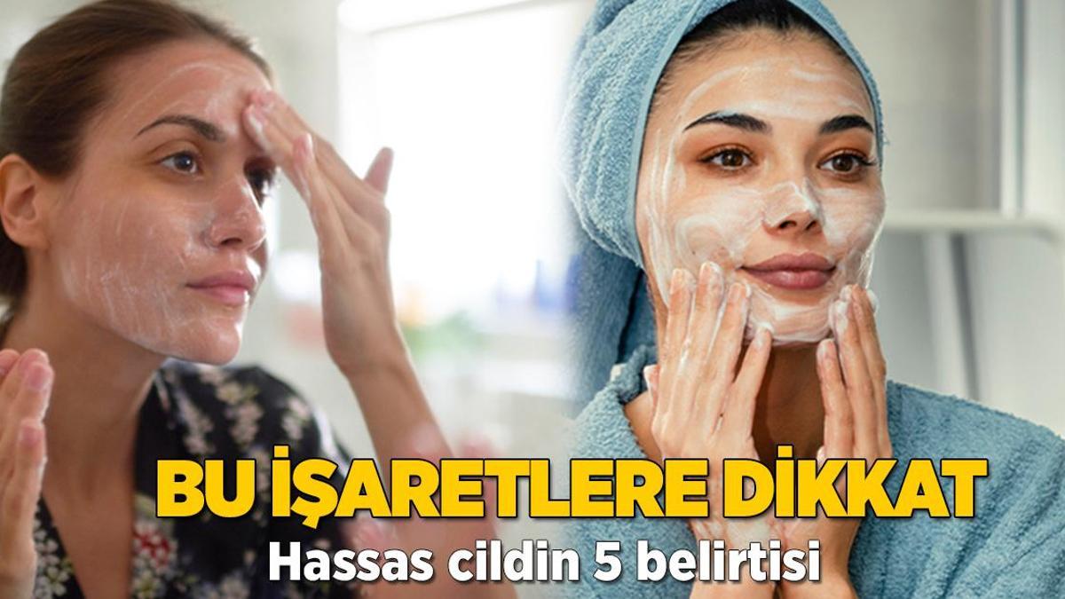 Bu işaretlere dikkat! Hassas cildin 5 belirtisi