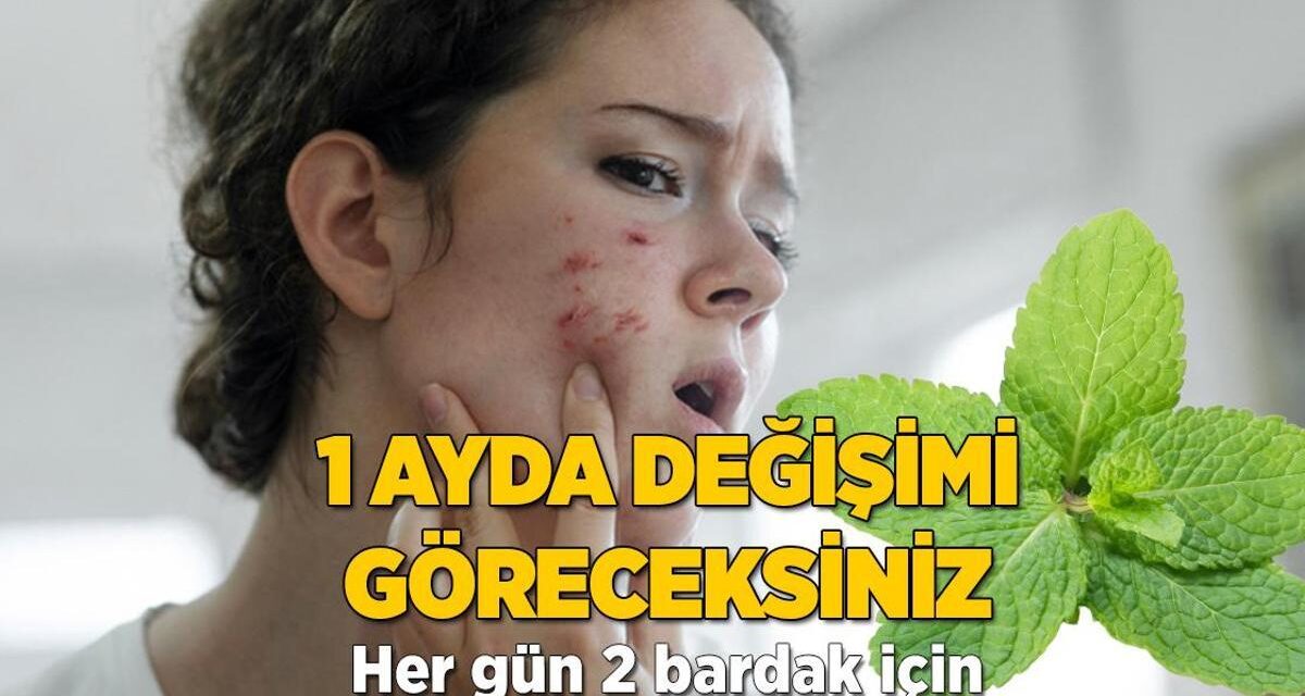 Naneden gelen güzellik! Her gün 2 bardak içince sivilceden eser kalmıyor