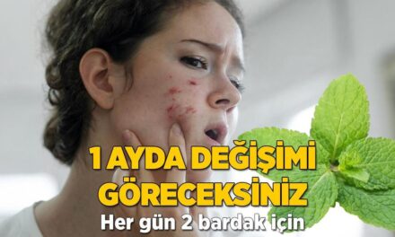 Naneden gelen güzellik! Her gün 2 bardak içince sivilceden eser kalmıyor