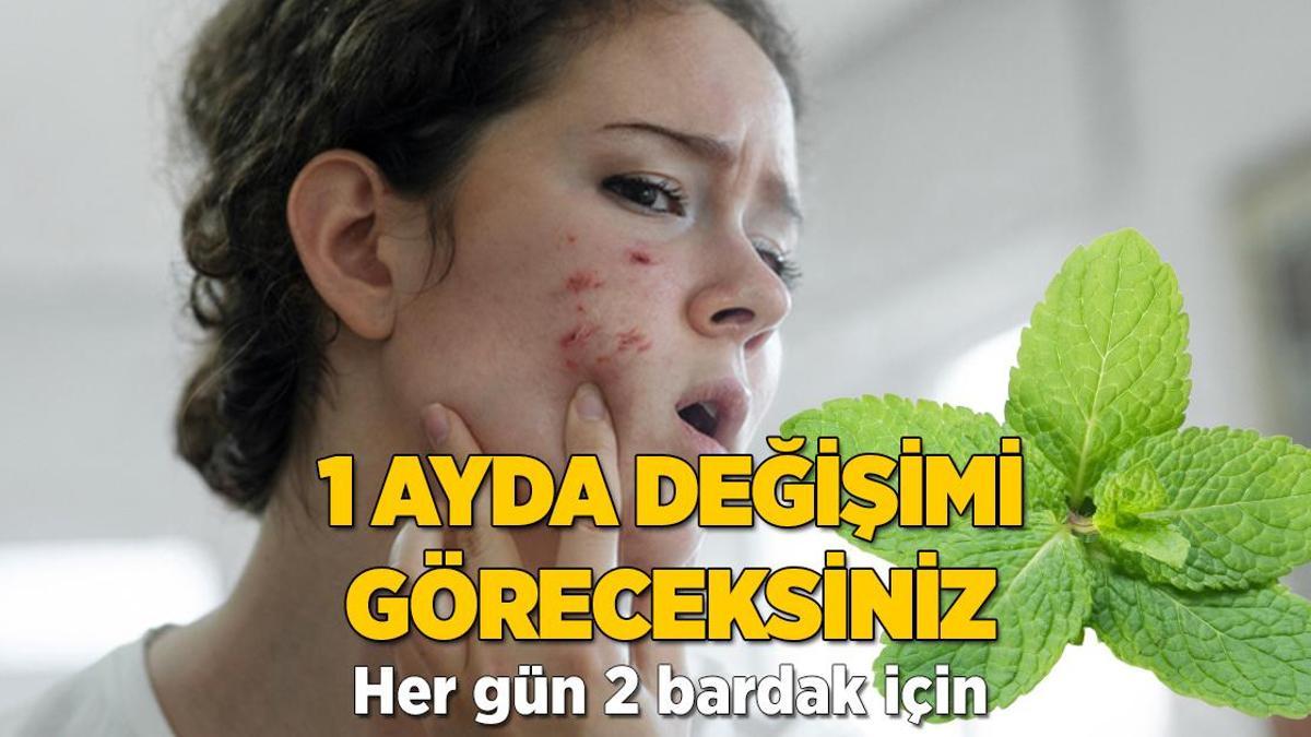 Naneden gelen güzellik! Her gün 2 bardak içince sivilceden eser kalmıyor
