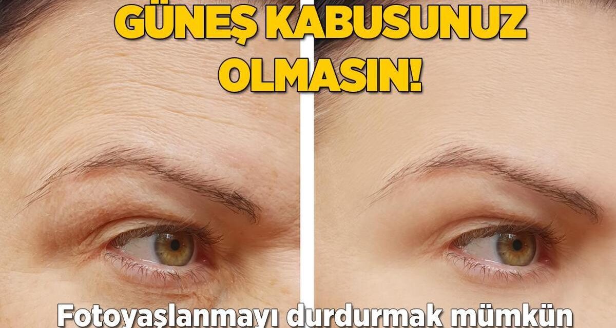 Fotoyaşlanmayı böyle durdurun! Bildiğimiz gibi değil, cilt altındaki hücreleri yok ediyor