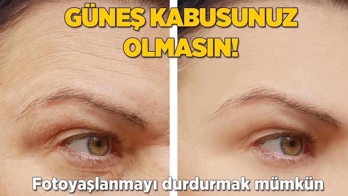 Fotoyaşlanmayı böyle durdurun! Bildiğimiz gibi değil, cilt altındaki hücreleri yok ediyor