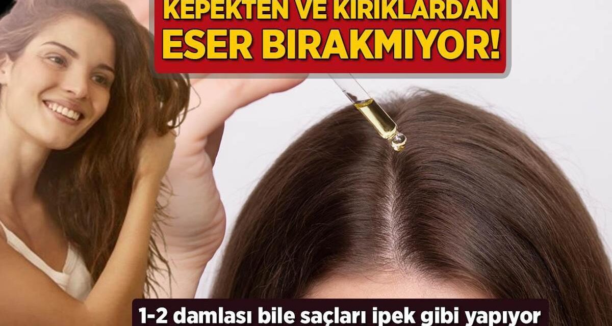 Kepekten ve kırıklardan eser bırakmıyor! 1-2 damlası bile saçları ipek gibi yapıyor