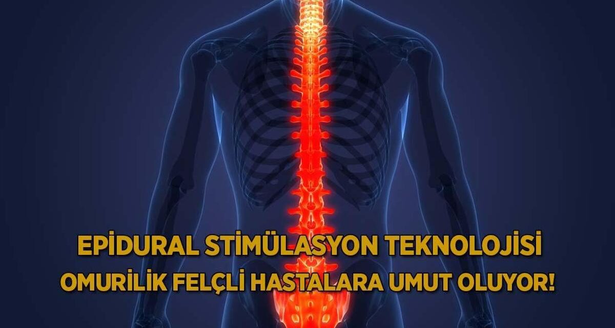 Epidural stimülasyon teknolojisi omurilik felçli hastalara umut oluyor!