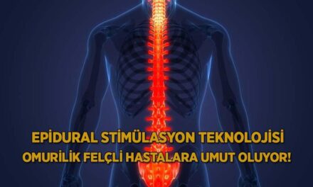 Epidural stimülasyon teknolojisi omurilik felçli hastalara umut oluyor!