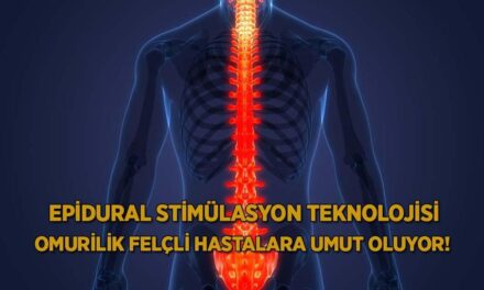 Epidural stimülasyon teknolojisi omurilik felçli hastalara umut oluyor!