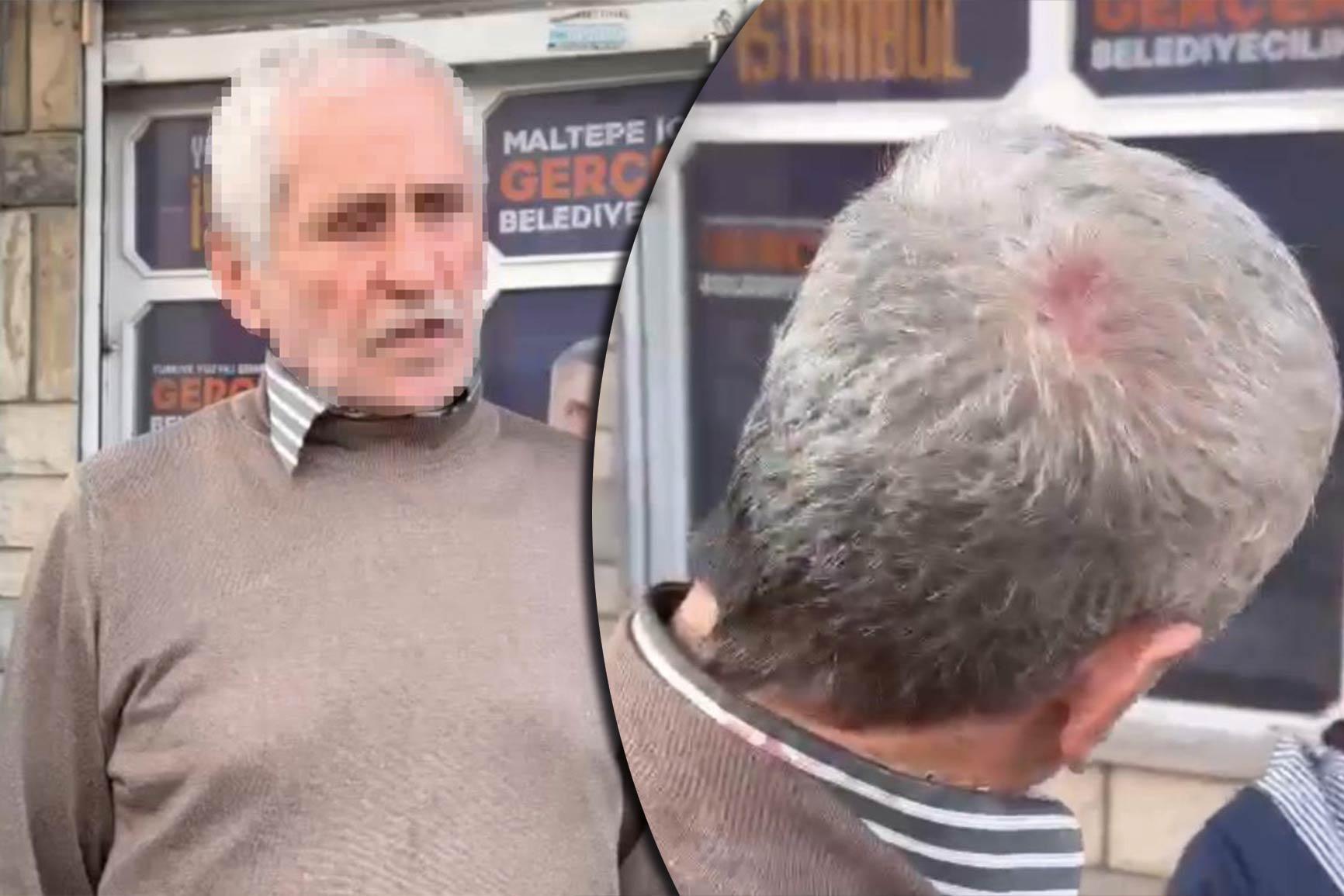 Maltepe’de broşür dağıtan AK Partiliyi darp etmişlerdi, 6 kişi gözaltına alındı