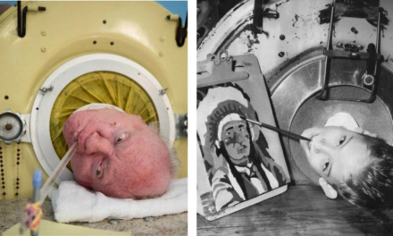 Metal bir tankın içinde hayat: Paul Alexander’ın inanılmaz hikâyesi